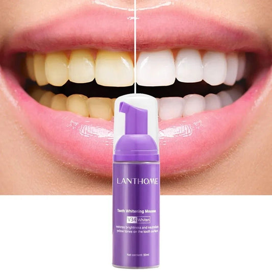 Mousse blanchissante pour dents